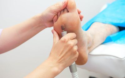 Laser Treatment for Nail Fungus